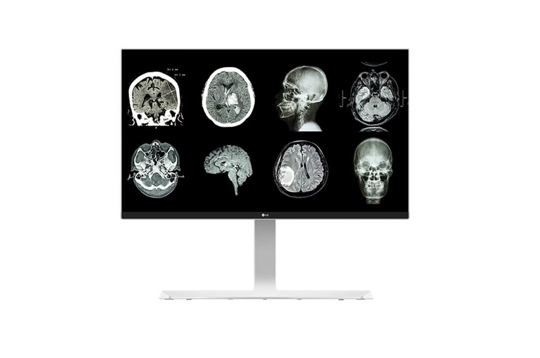 27 (68.58cm) UHD 8MP Clinical Review Monitor